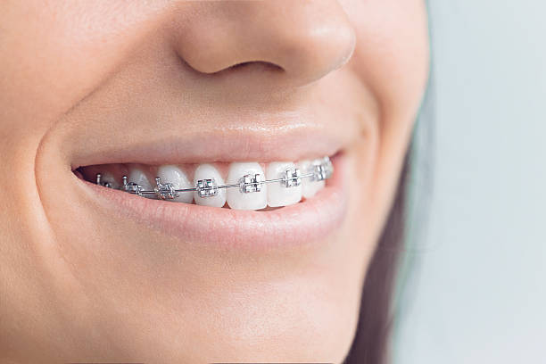 Best Laser Dentistry  in Stepping Stone, CO